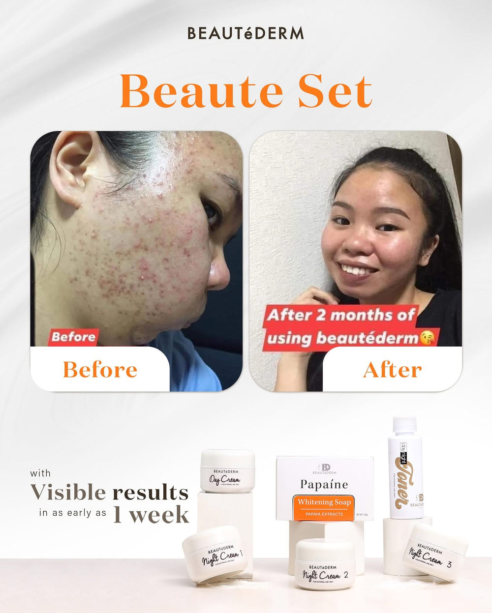 SALE! Beaute Regular Set Upgraded Toner 120ml
