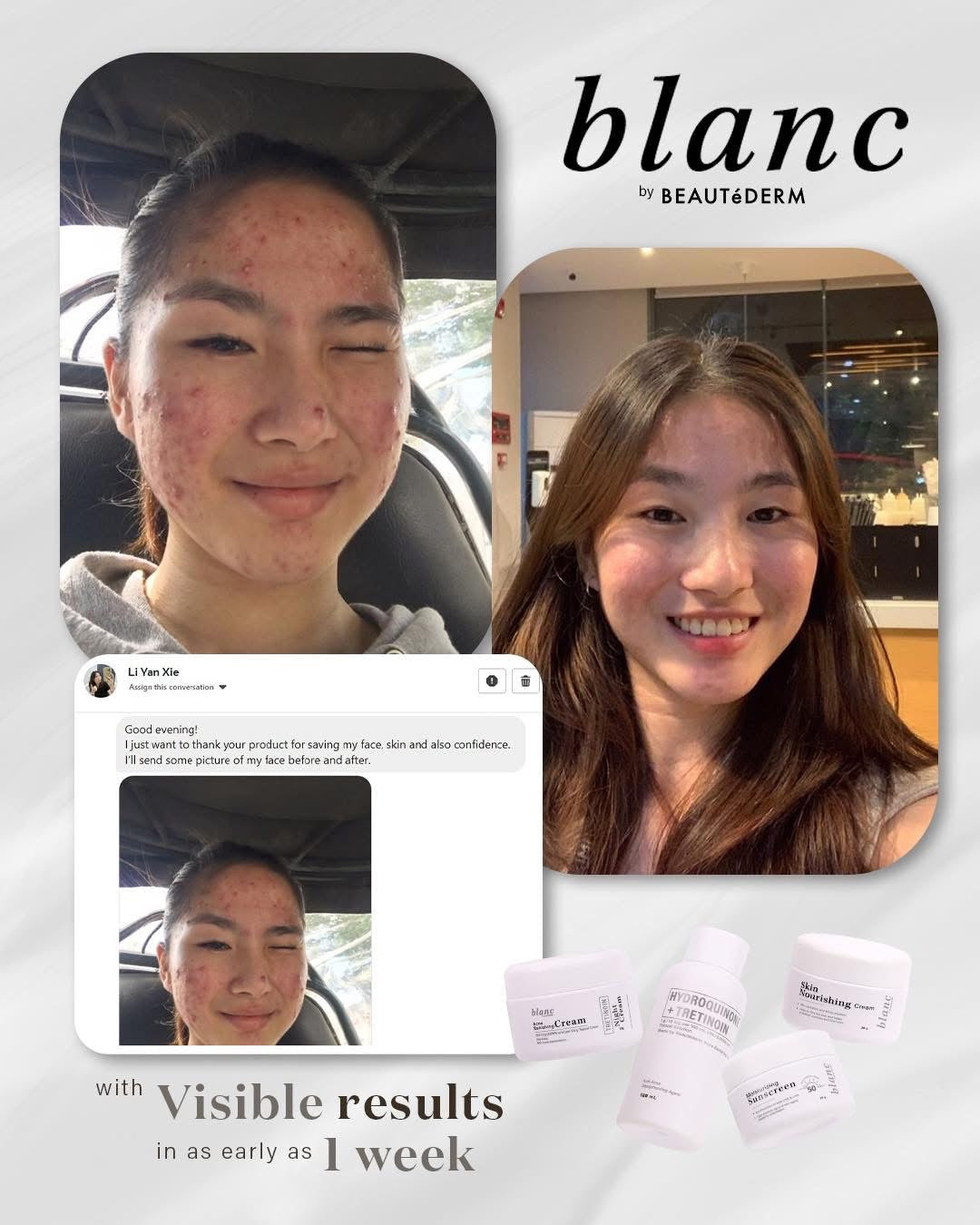 BUY 1 TAKE 1 ! Blanc Trial Set